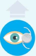 eyedetec cataract